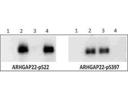 ARHGAP22, p Ser22 Antibody, Novus Biologicals 0.05mg; Unlabeled:Antibodies,